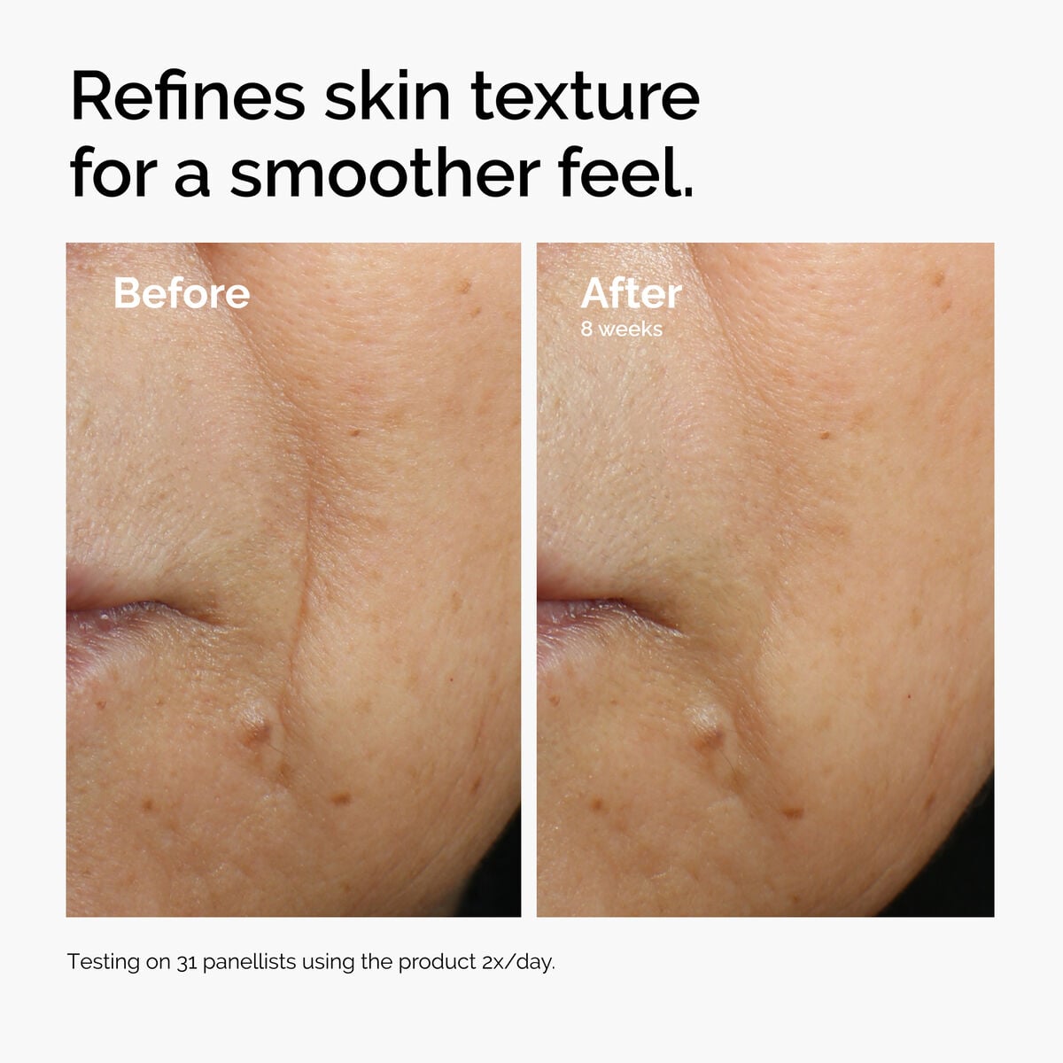 Caffeine + Escin Face Serum Targeted Serum Care T4