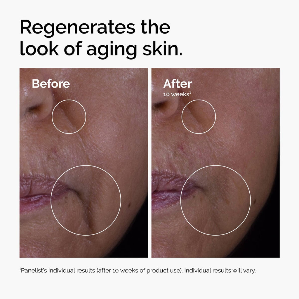 GF Solution Targeted Serum Care M1