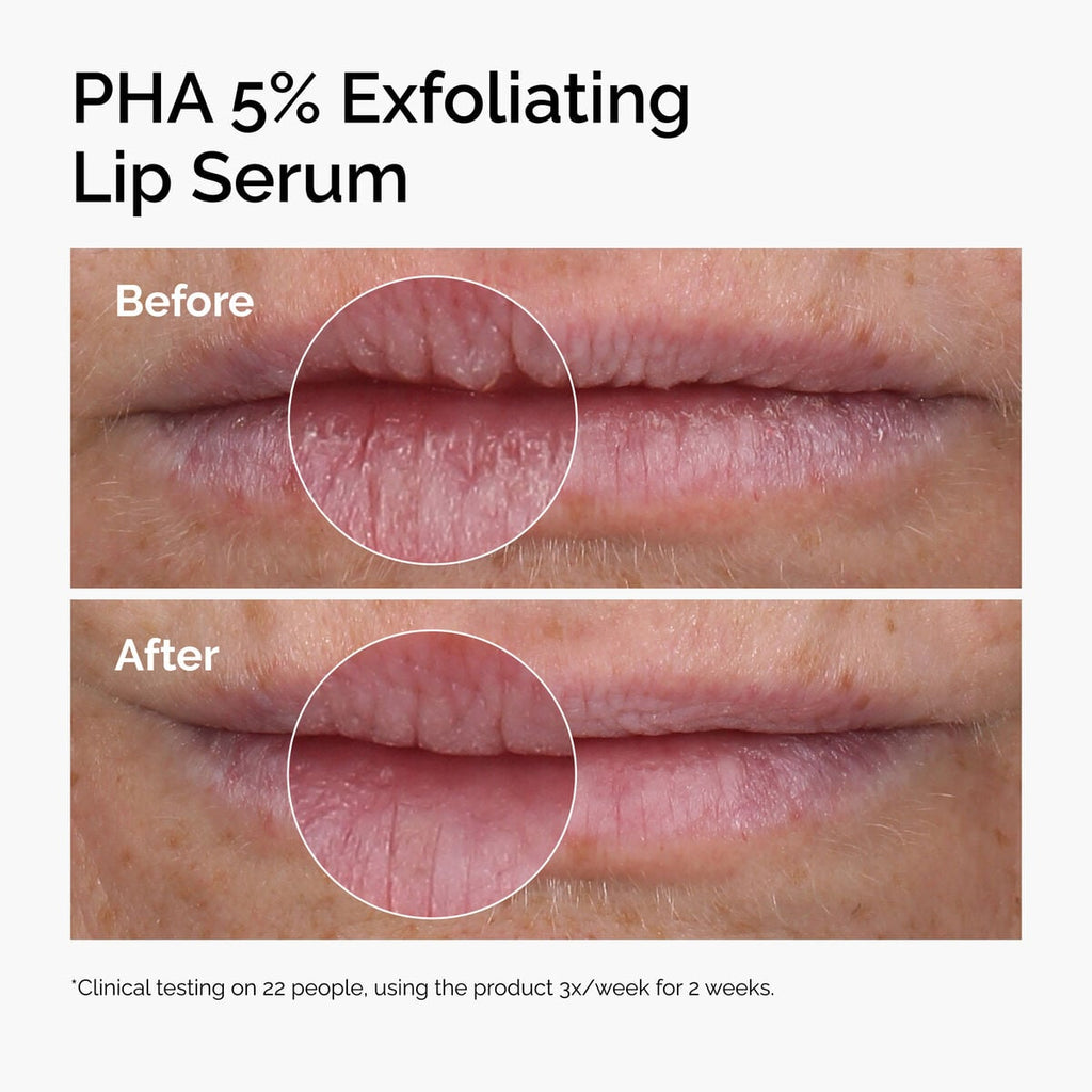 PHA Exfoliating Lip Serum Daily Treatment Ritual Q2
