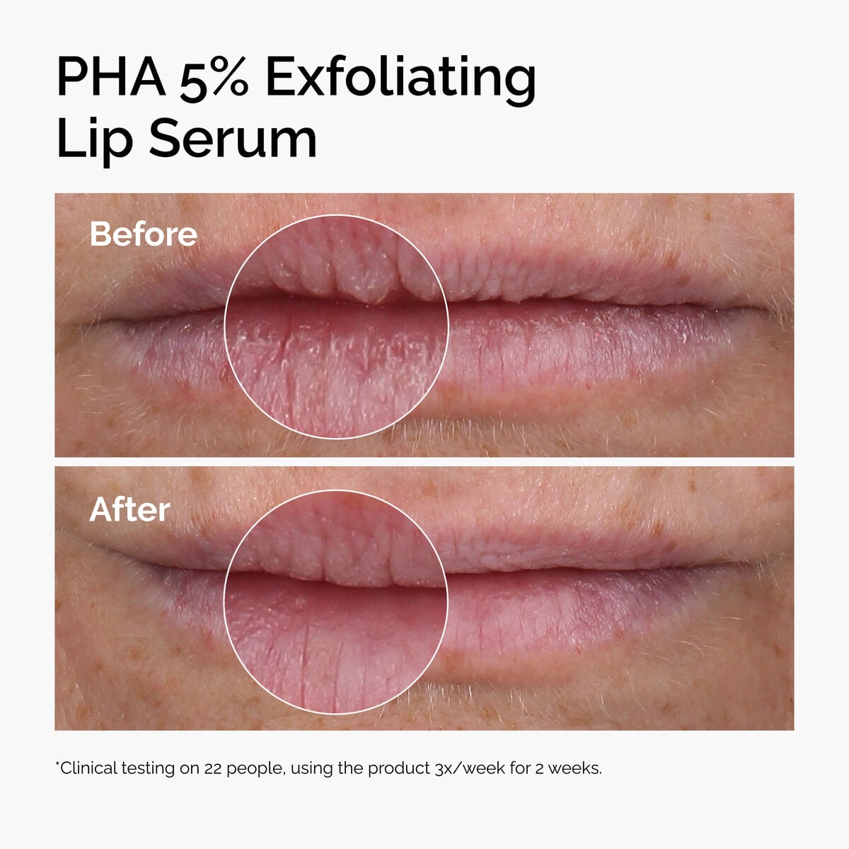 PHA Exfoliating Lip Serum Targeted Serum Care C5